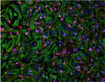 Revert, the dream of overcoming neuro-degenerative illnesses