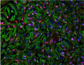 Revert, o del sogno di vincere le malattie neurodegenerative - Cellule staminali celebrali